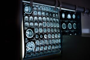九州の温泉で更年期の自律神経を整える方法は？